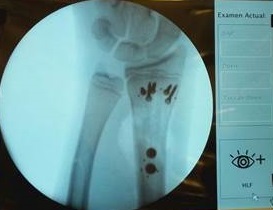 Postoperatorio-Mariano-Obaid-Grupo-Gamma